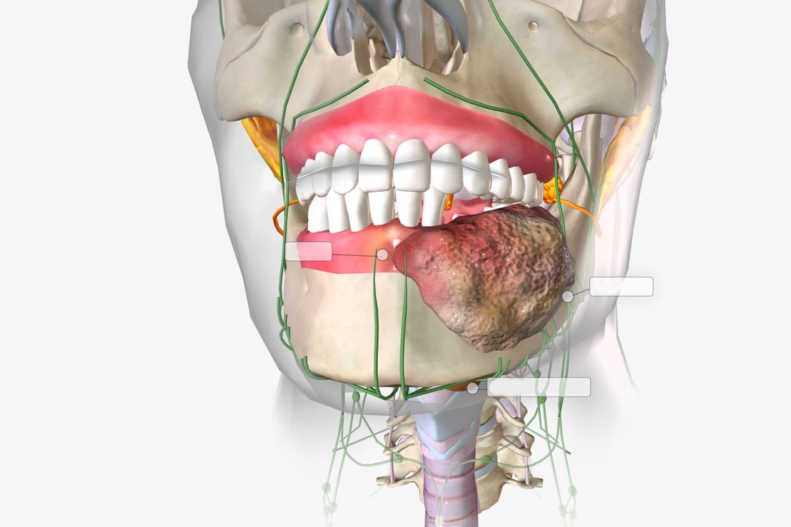 زراعة الأسنان