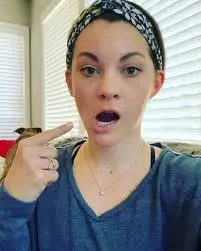 علاج انحراف الفك: متى يكفي التقويم ومتى تحتاج جراحة؟ (دليل شامل) علاج انحراف الفك2