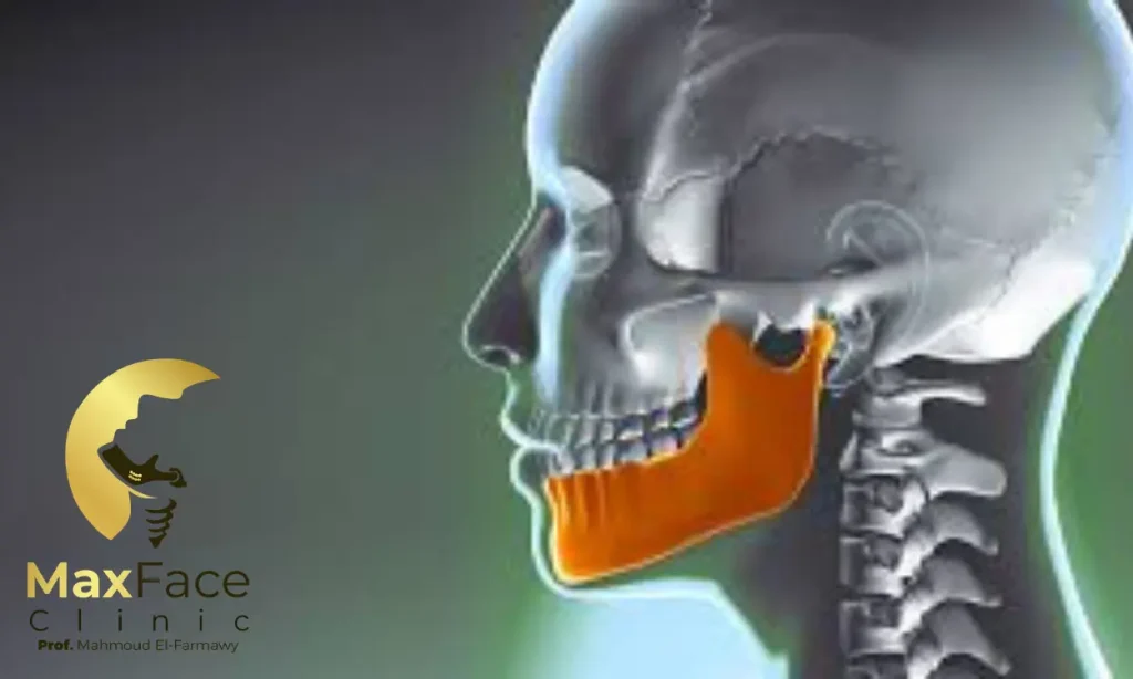 متى تحتاج عملية مفصل الفك؟ علامات تدل على ضرورة الجراحة متى تحتاج عملية مفصل الفك