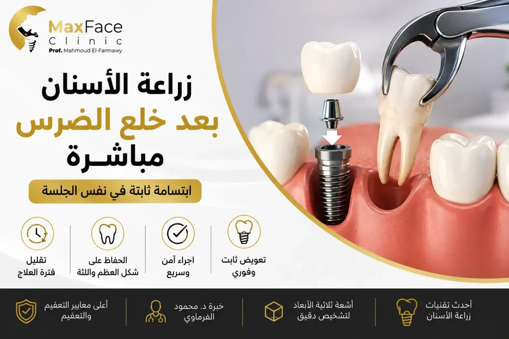 زراعة الأسنان بعد خلع الضرس مباشرة
