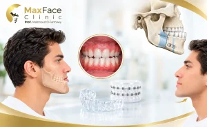 علاج العضة المعكوسة
