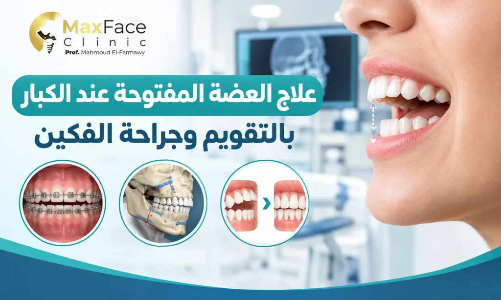 علاج العضة المفتوحة عند الكبار